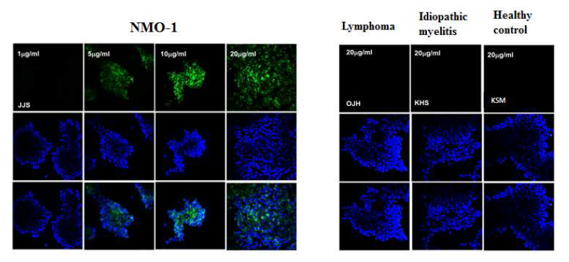 NMO 환자의 plasma와 AQP4를 과발현하는 HEK-293T cell line과의 dose dependent한 binding response