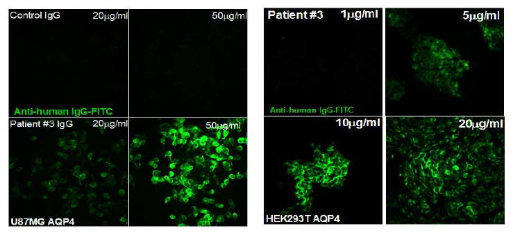 NMO-IgG의 dose dependent하게 증가하는 AQP4 과발현 cell line과의 binding response