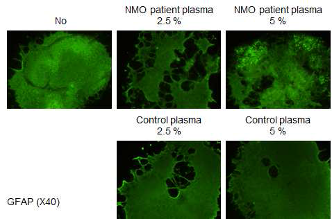 NMO ex vivo model (spinl cord slice culture system)에서 NMO 환자로부터 얻은 plasma protein에 의한 GFAP의 발현 감소