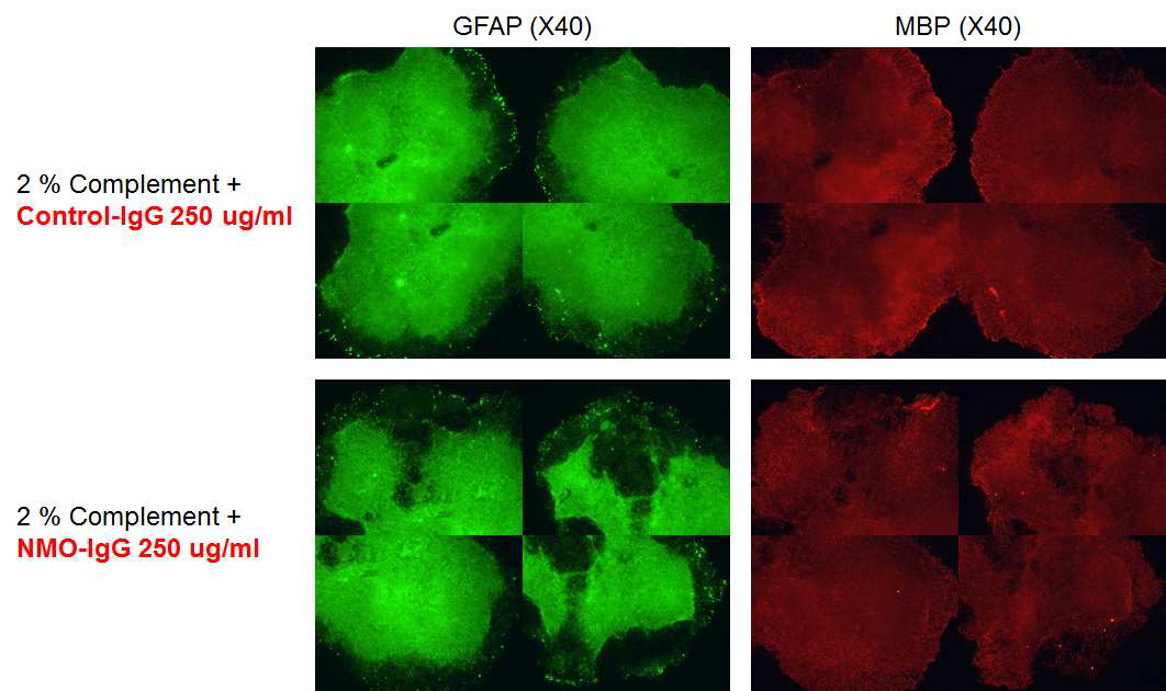 NMO ex vivo model (spinal cord slice culture system)에서 NMO-IgG와 complement에 의한 GFAP, MBP의 발현 감소