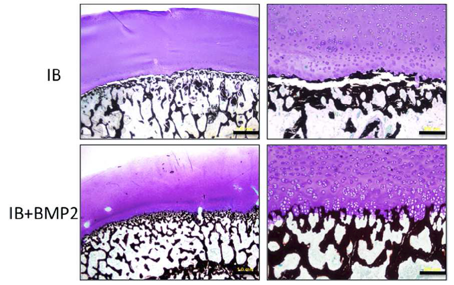 비스포스포네이트 단독 투여 (IB)시 연골하 부위 골소주 형성이 부족하며 분리되어 있으나, 비스포스포네이트와 BMP_2를 병합 투여(IB+BMP2) 병합 투여시 골소주 형성이 현저히 재생되는 소견이 보임