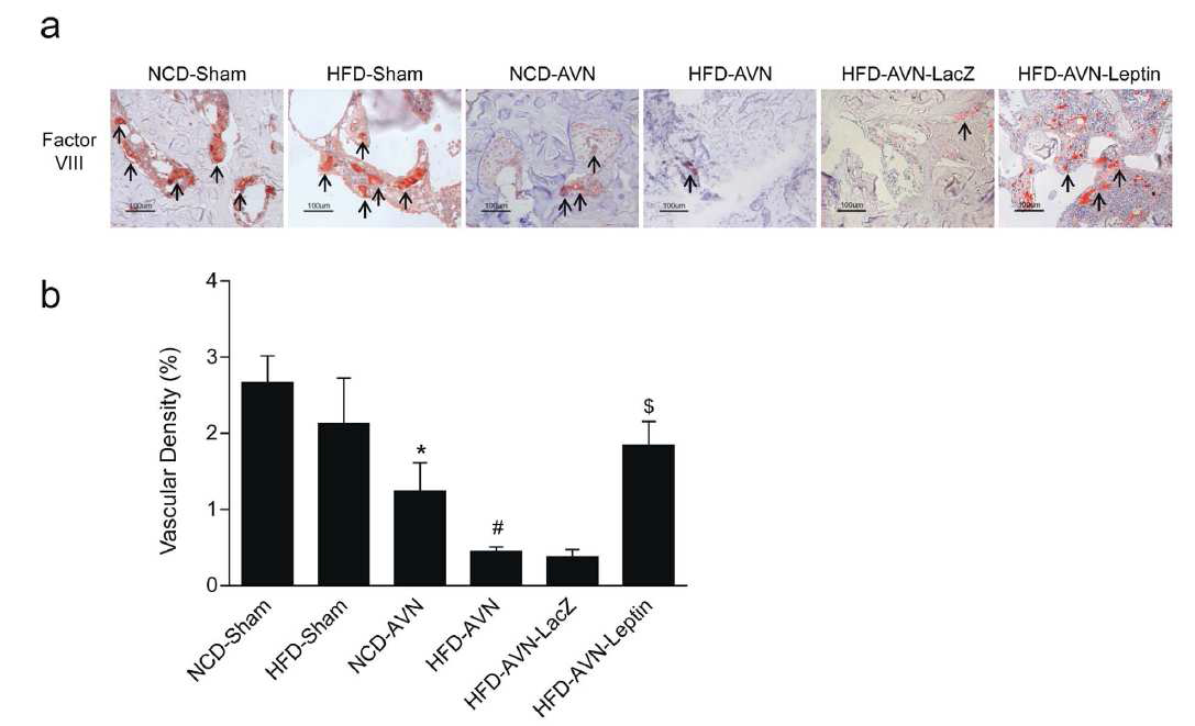 Factor VIII 항원에 대한 면역조직화학 염색 및 무혈성 괴사 부위 혈관 염색 정도.