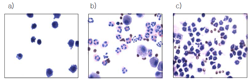 BAL cell Giemsa staining