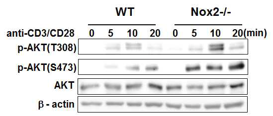 Nox2 결여에 의해 증가한 Akt의 인산화