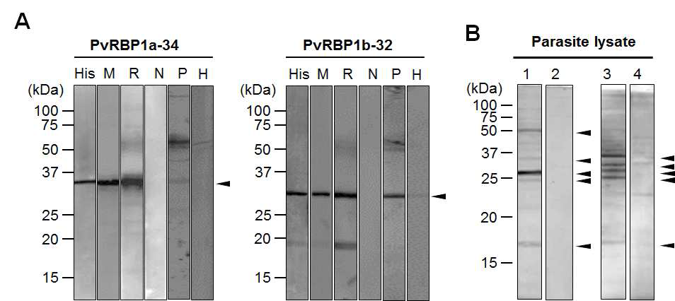 (A) PvRBP1a, (B) PvRBP1b, M, Protein Marker; His, His-taq; M1, Mouse1; M2, Mouse2; Post R, Immunized Rabbit; Pre R, Non-immunized Rabbit.