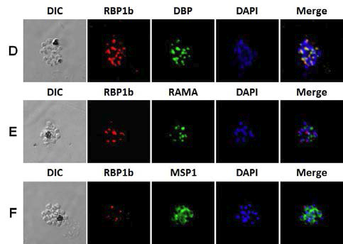 PvRBP1b의 원충 내 분포