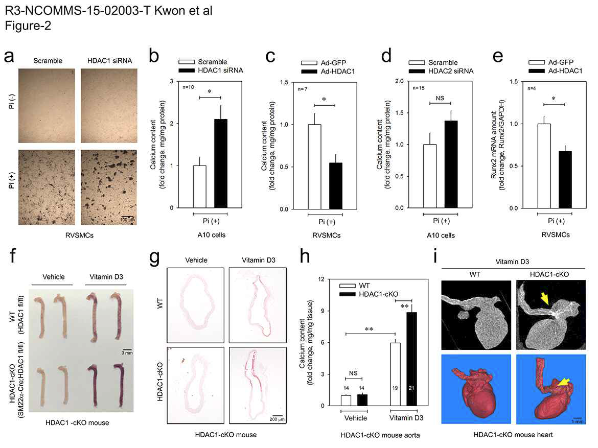 Loss of HDAC1 enhances VC.