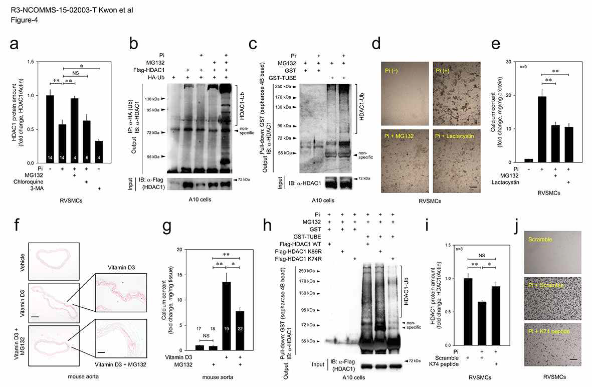 HDAC1 is ubiquitinated in VC.