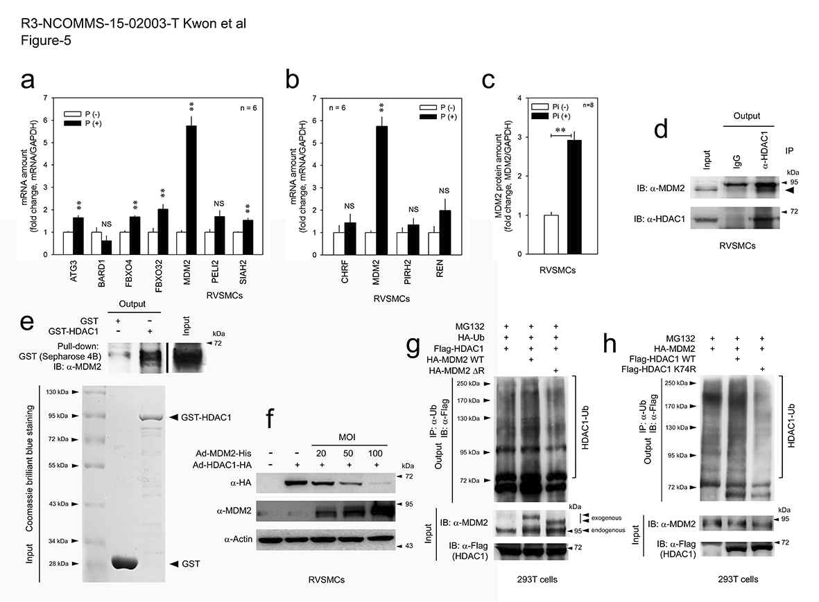 MDM2 E3 ligase induces degradation of HDAC1.