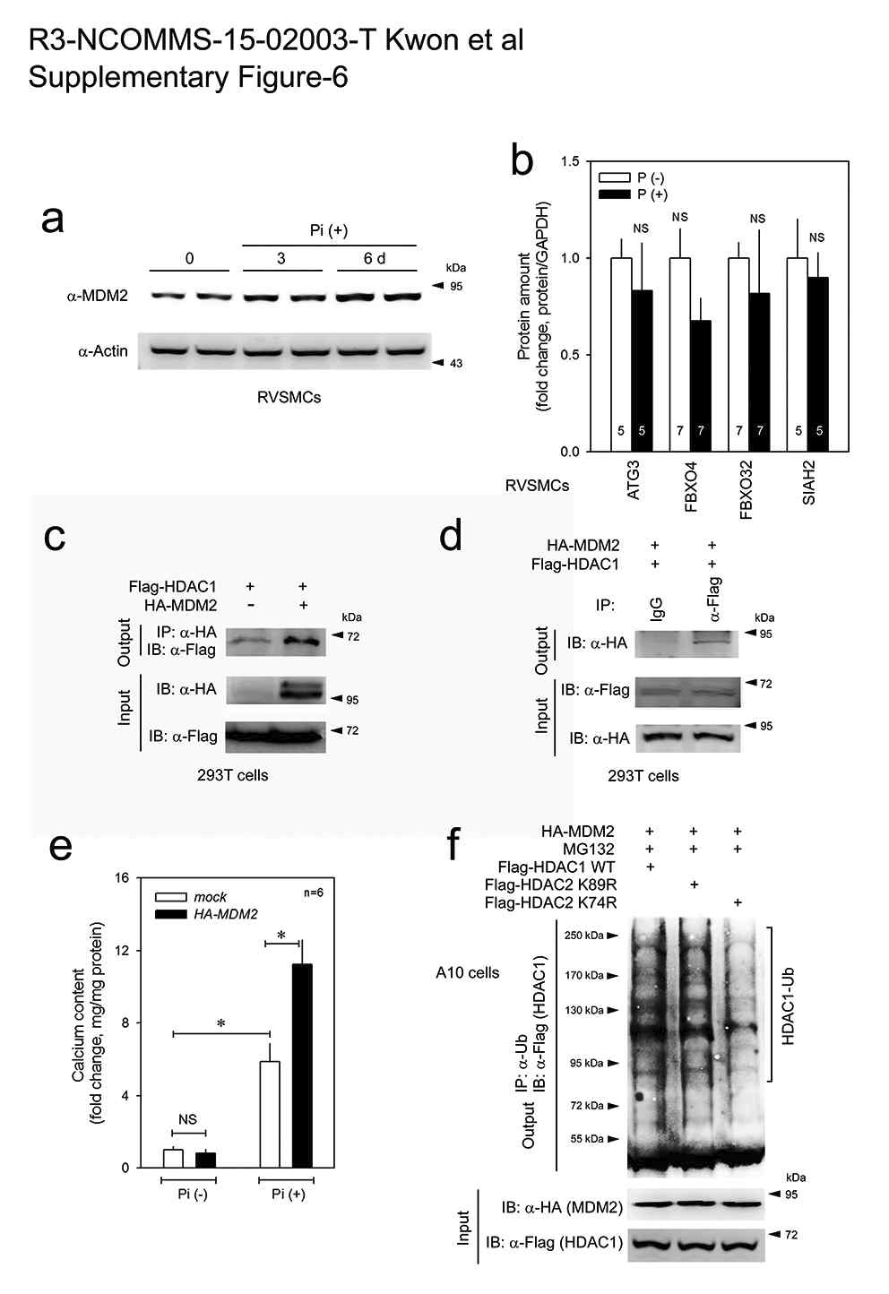 MDM2 physically interacts with HDAC1 and potentiates calcium deposition.