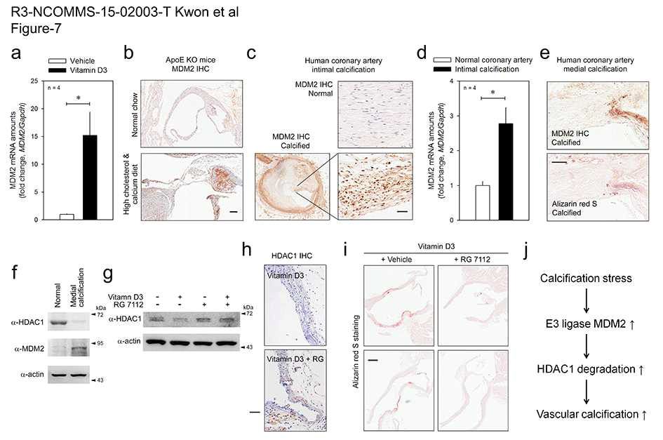 MDM2 is upregulated in VC models and inhibition of MDM2 activity reduces VC in mice.