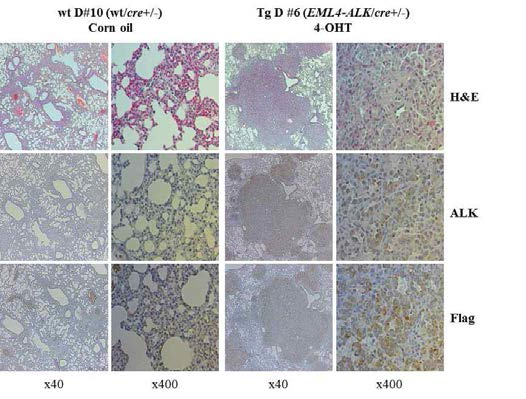 Tamoxifen 투여에 의해 생성된 폐암에서 EML4-ALK 에 EML4-ALK 발현 확인 의해 유도된 tumor를 조직면역염색으로 확인