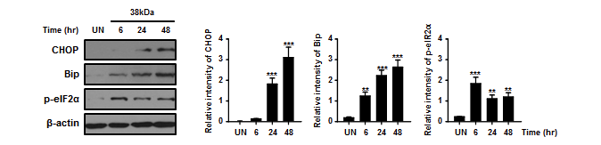 결핵균 38kDa항원이 마우스 BMDM세포로부터 유도하는 CHOP, Bip, eIF2-alpha 인자들