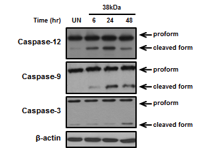 결핵균 38kDa항원 자극과 caspase활성과의 상관관계
