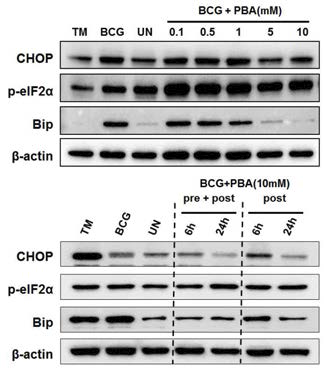 결핵균 BCG감염과 소포체 스트레스 완화와의 상관관계 규명을 위한 4-PBA의 효과