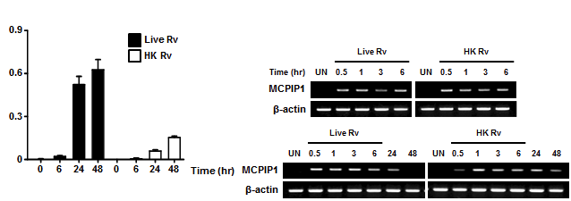 결핵균 생균과 사균 감염에 의해 유도되는 MCP-1의 생성과 MCPIP 발현