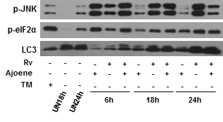 결핵균 감염시 발생하는 p-eIF2a와 JNK인산화의 발현과 autophagosome형성과의 상관관계 비교를 위한 웨스턴 블라팅 분석