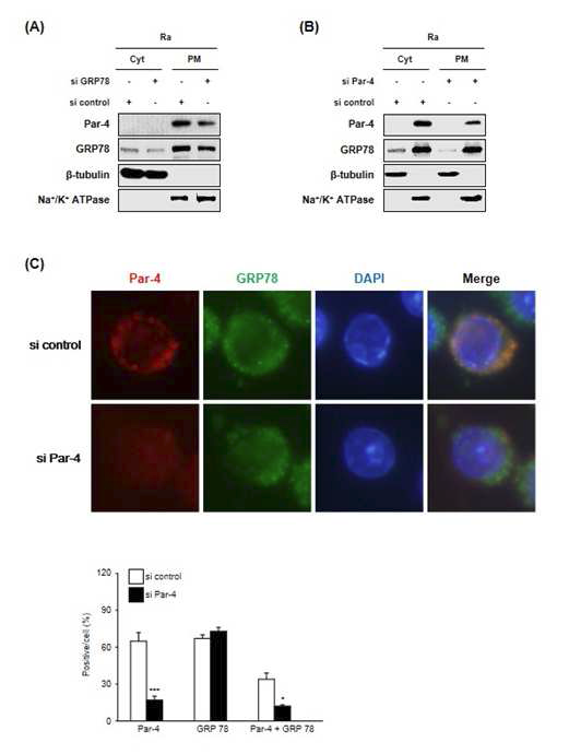 결핵균 감염시 증가하는 Par-4단백질의 이동에 영향을 주는 siRNA 효과