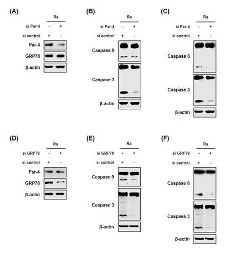 siRNA에 의한 Par-4이동 제한이 caspase의존적 세포자멸사에 미치는 효과