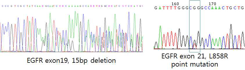 비소세포폐암 환자의 조직에 대한 direct DNA sequencing을 이용한 mutation 분석의 예