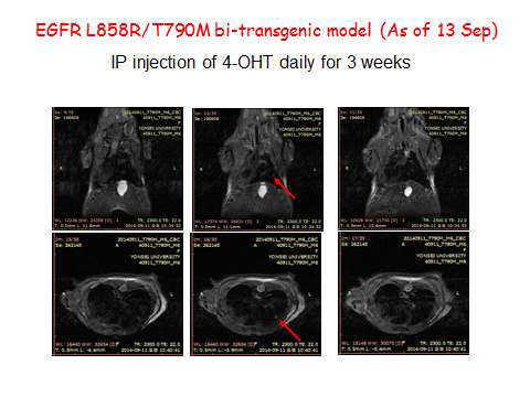 cre에 의한 EGFR-L858R-T790M 발현 폐암이 유도된 형질 전환 마우스 MRI.