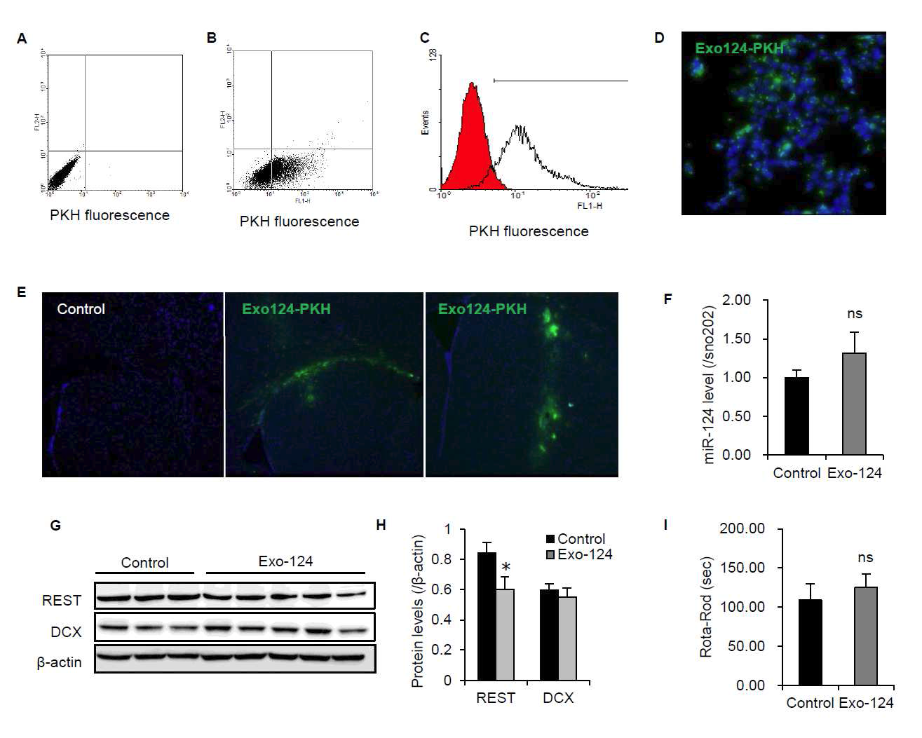 Delivery of Exo-124 in and therapeutic effects in Huntington’s disease model.