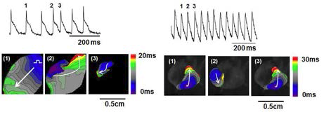 Tiggered activity (left) 및 심실빈맥 (right)의 optical 맵핑.