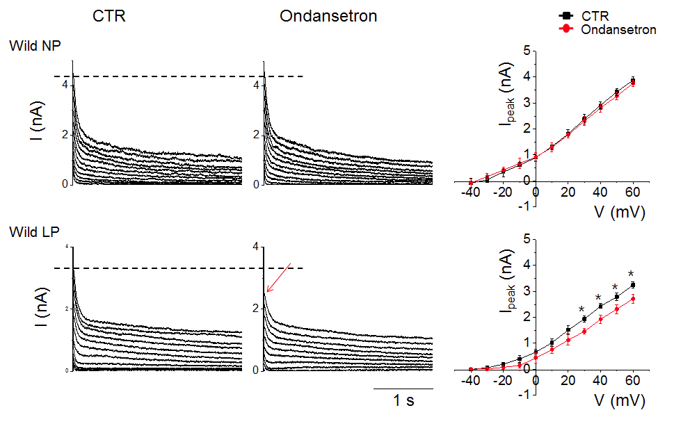 5Ht3a 수용체 차단제인 ondansertron의 total potassium outward current에 미치는 영향