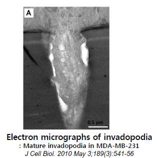 Electoron micrographs of invadopodia (J Cell Biol, 2010, 189:541-556)