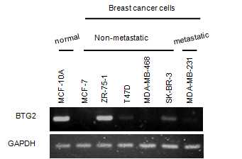 BTG2 expression in breast cancer cell lines