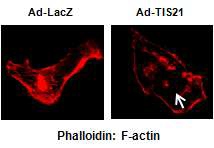 F-actin staining after TIS21 overexpression