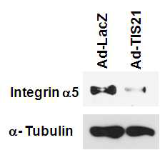 Expression of integrin α5 was suppressed by transduction of Ad-TIS21