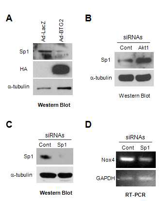 BTG2-Akt1-linked pathway negatively regulates SP1 and Nox4 expression