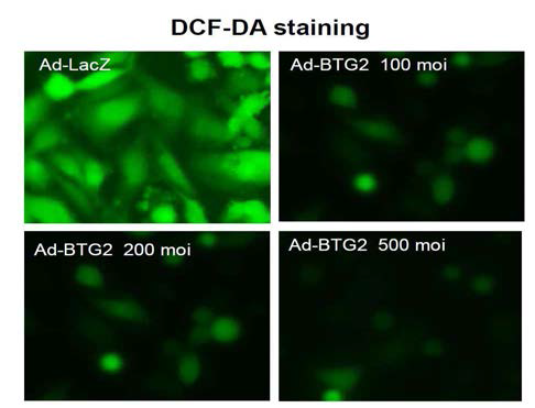 DCF-DA staining after Ad-BTG2 infection in MDA-MB-231 cells