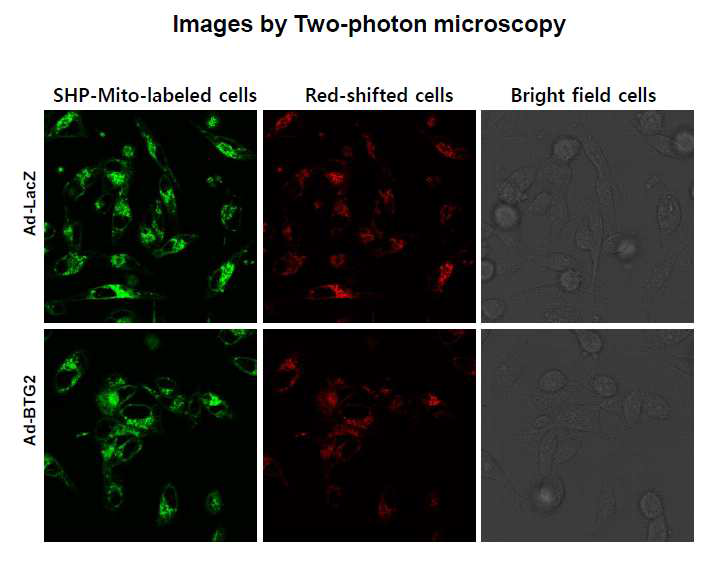 Two-photon microscope analysis after SHP-Mito staining in MDA-MB-231 cells infected with adenovirus carrying BTG2 gene