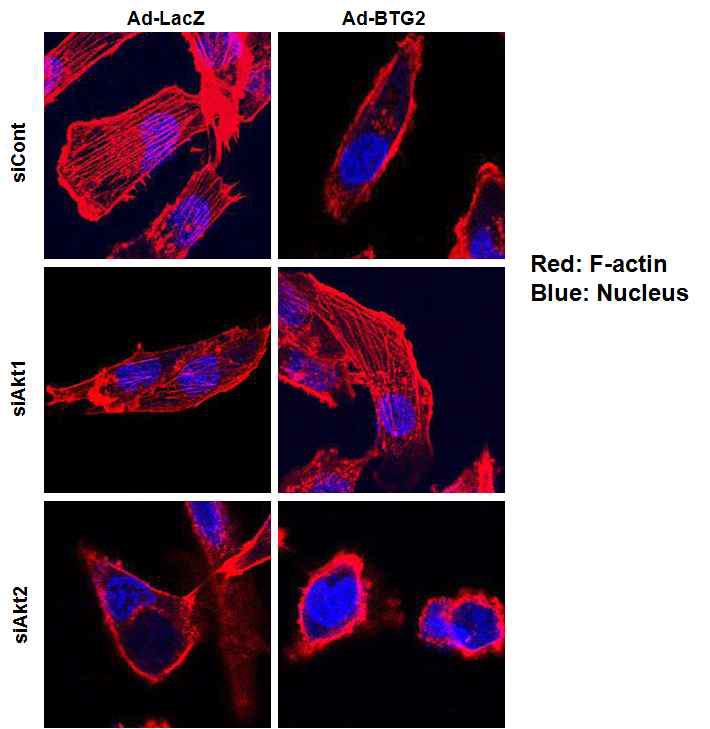 F-actin staining after Ad-BTG2 infection in MDA-MB-231cells transfected with siRNA- Akt1 or siRNA-Akt2