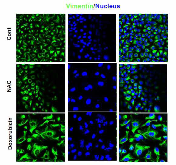 NAC effect of doxorubicin-induced vimentin distribution in Huh-7 cells
