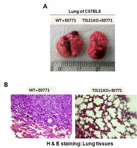 Lung metastasis by tail-vein injection in C57BL6-TIS21KO mice