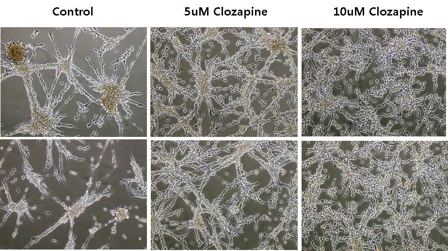 Captured cell images at 4 days of clozapine treatment in U87 cells