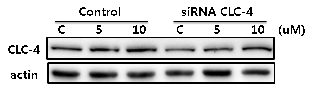 Clozapine-induced CLC-4 expression was suppressed by human CLC-4 siRNA