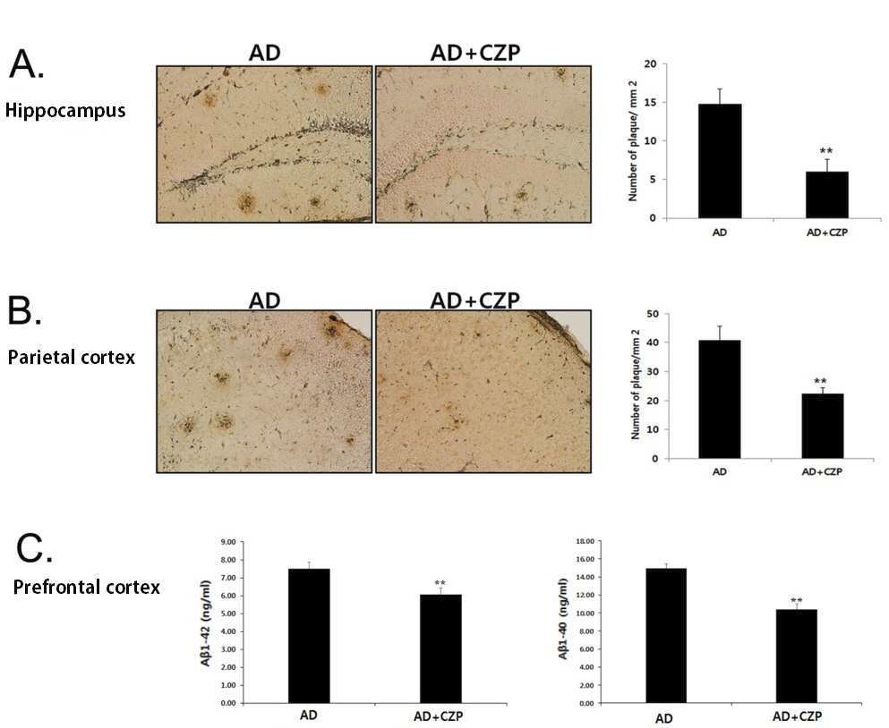 Administration of clozapine reduced Aβ level and Aβ plaques in the brain of APP/PS1 AD mice