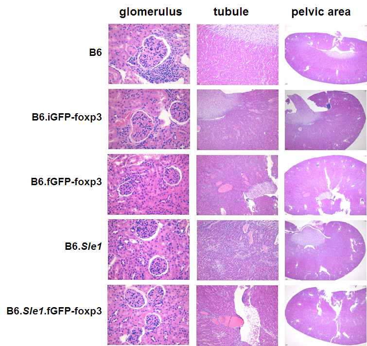 Histopathology of kidney