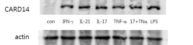 Hacat kerainocyte에서의 cytokine에 의한 CARD14 protein의 발현 확인