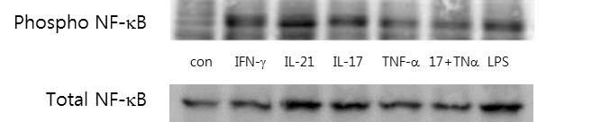 IL-21 및 건선관련 cytokine에 의한 NF-κB activation 확인