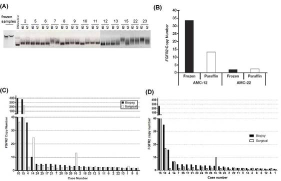 (A) 생검 조직과 수술 조직의 DNA 전기영동 (B) 파라핀 포매 조직과 동결 조직의 DNA로부터 qPCR에 의한 FGFR2 유전자 copy 수 비교. HS0518242482 (C)와 HS05114211 (D)의 qPCR에 의한 파라핀 포매의 생검 및 수술조직 비교