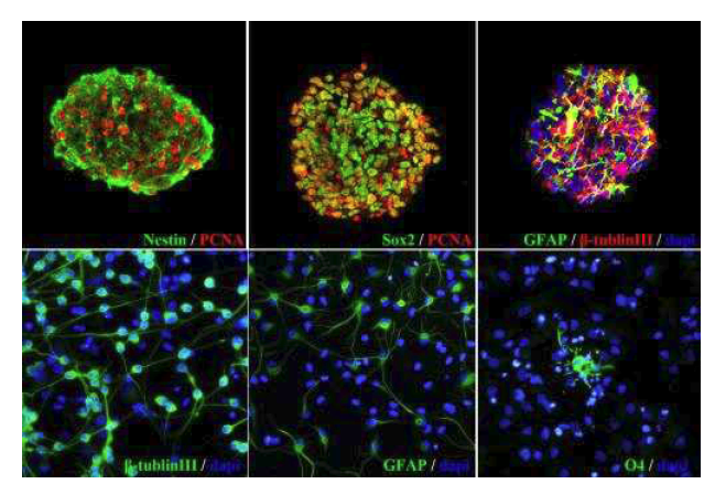 Neurosphere의 단면에서 면역조직화학 염색 결과 신경줄기세포 표지자인 nestin, Sox2가 증식세포 표지자인 PCNA와 동시 발현되고 있고, neuronal progenitor 표지자인 beta-tubulinIII와 astroglial progenitor 표지자인 GFAP를 발현하고 있어 신경줄기세포와 일부 신경전구세포의 특성을 동시에 갖고 있음을 확인함(upper panel).