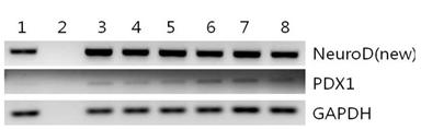 눈지방 줄기세포를 1세부제공 ID1/ID2분화배지로 배양한 후 유전자 발현양상을 RT-PCR로 분석함.