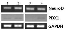 눈지방 줄기세포를 1세부에서 출판한 논문 또는 명시된 분화배지조성에 따라 분화유도배양한 후 유전자발현양상을 RT-PCR로 분석함.