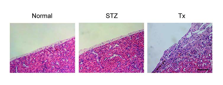 사람 지방유래 줄기세포로부터 분화 유도된 중분화 베타세포를 이식 받은 생쥐 신장의 모습.
