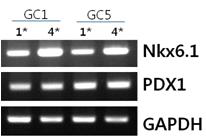 눈지방 줄기세포(GC1,5)의 cell spheroid 방법을 이용한 분화 배양 후 유전자 발현양상을 RT-PCR로 분석함. 명시된 번호는 자체적으로 조성한 분화배지의 생산번호임.
